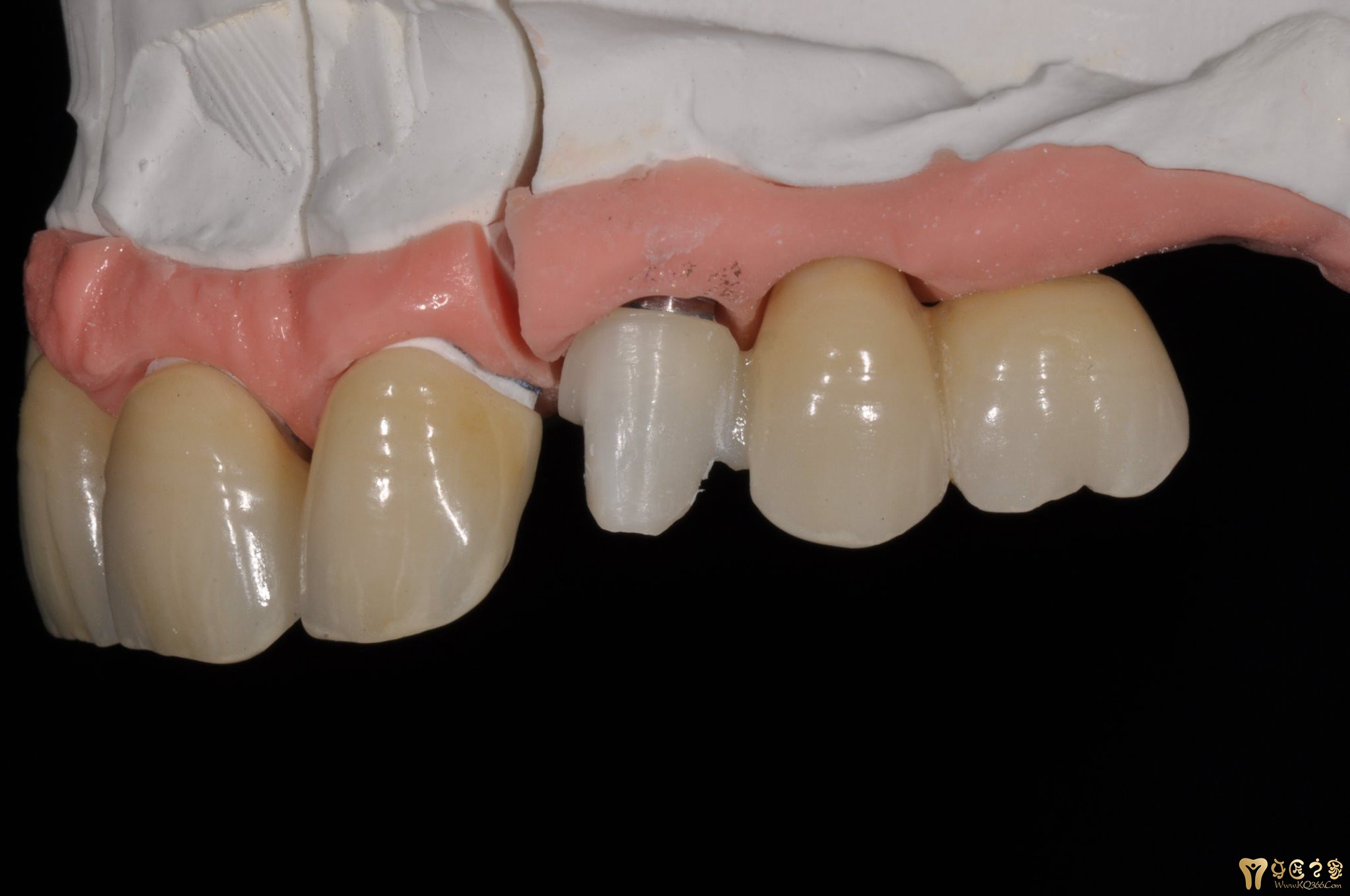 美学仿生案例 - 案例精华 - 牙匠之家